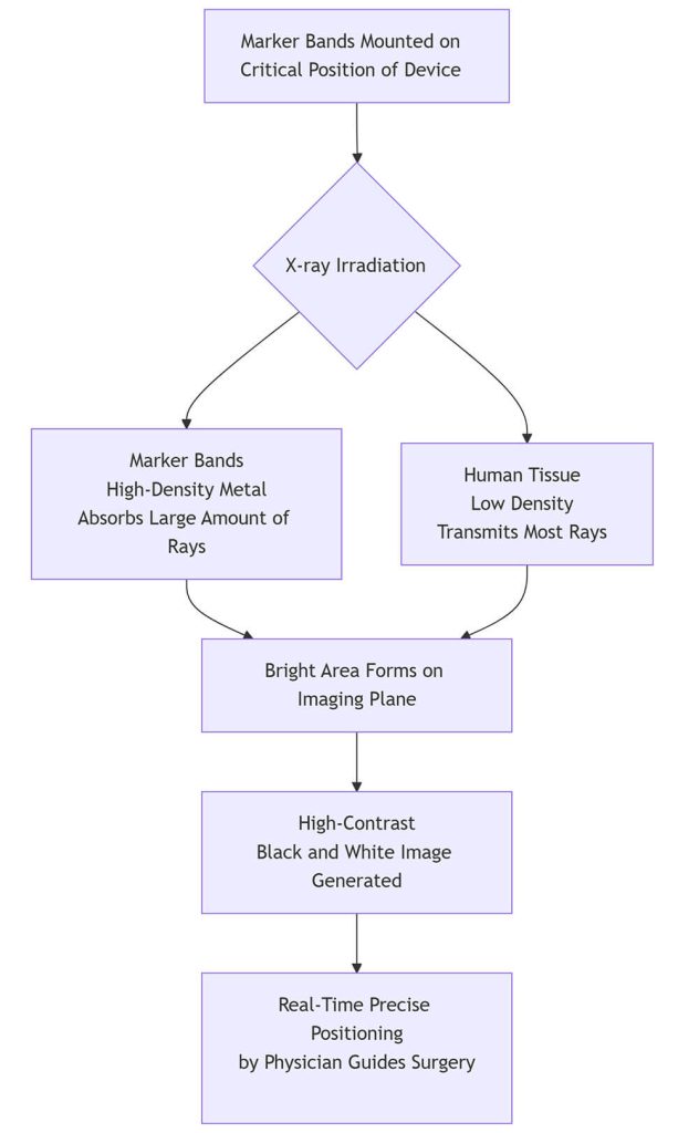 Working Principle of Marker Bands (Radiopaque Markers)